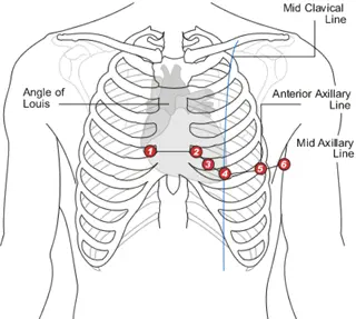Các lỗi thường gặp khi đo điện tim