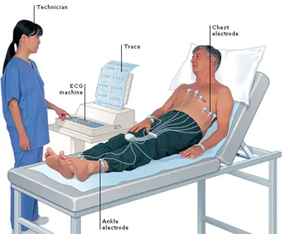 Các lỗi thường gặp khi đo điện tim